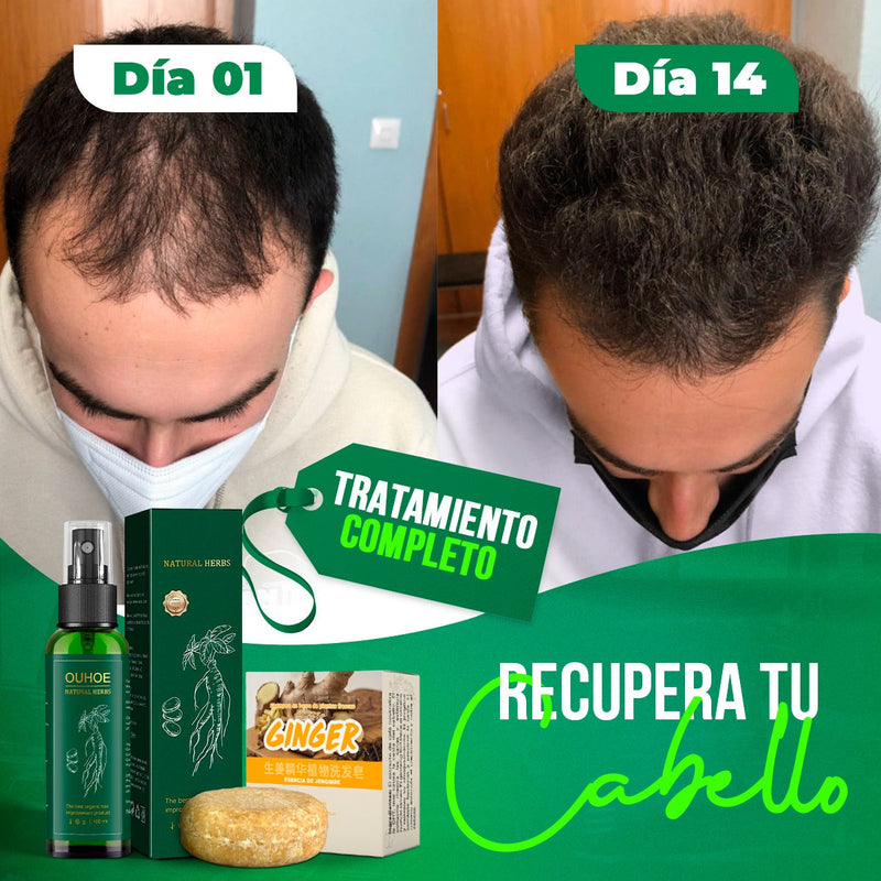 OUHOE Spray Crece Pelo