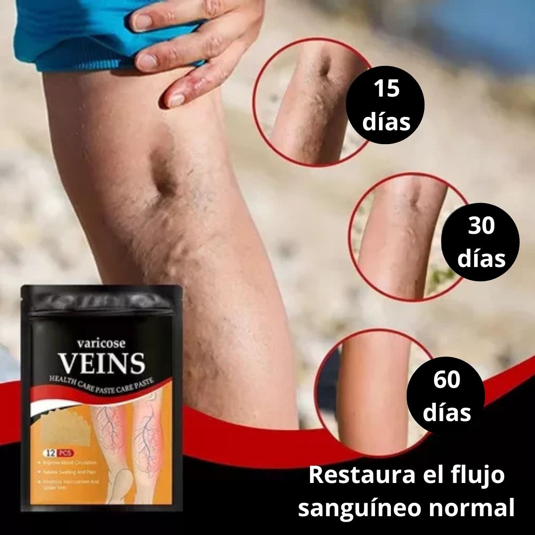 Parche varicose Veins para vena varice