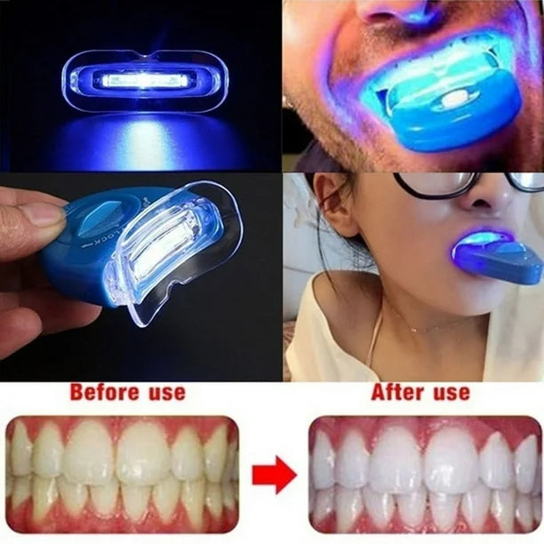 KIT BLANQUEADOR DE DIENTES 20 MIN